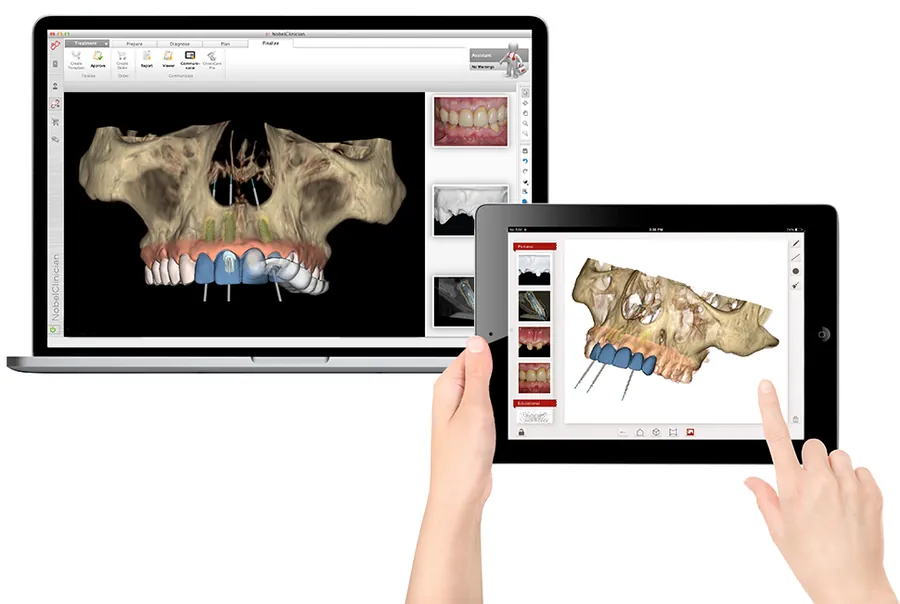 Dental CAD designing